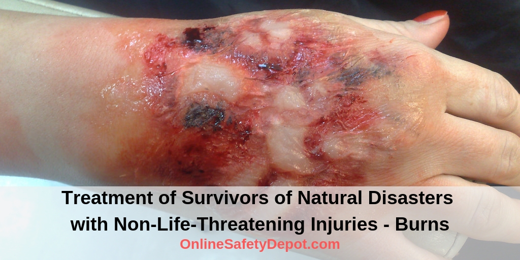 Treatment of Survivors of Natural Disasters with Non-Life-Threatening Injuries - Burns